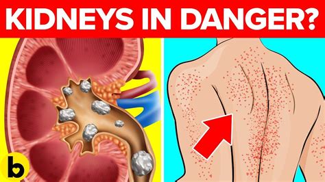 12 Signs That Your Kidneys Need Help | Kidney failure causes, Kidney disease symptoms, Itching skin