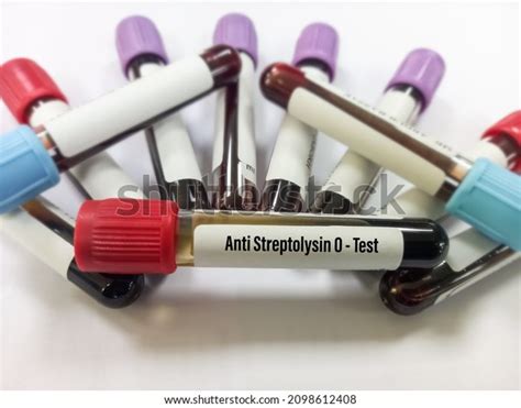 Blood Sample Antistreptolysin O Aso Titer Stock Photo 2098612408 ...