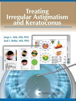 Treating Irregular Astigmatism and Keratoconus: Alio: 0009962613280 ...