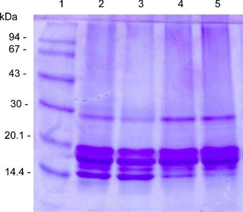 Protein Staining; Coomassie Brilliant Blue Staining