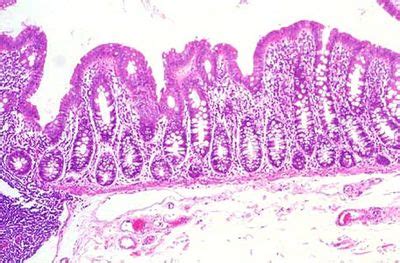 Large Intestine Histology - Large intestine - histology slide