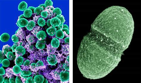 Enterococcus Urinary Tract Infection