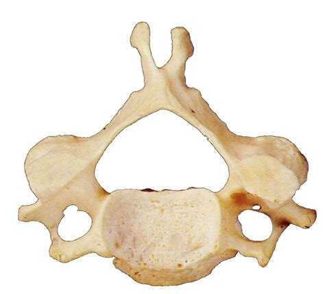 Figure 3. A middle cervical vertebra of a human in cranialview showing ...
