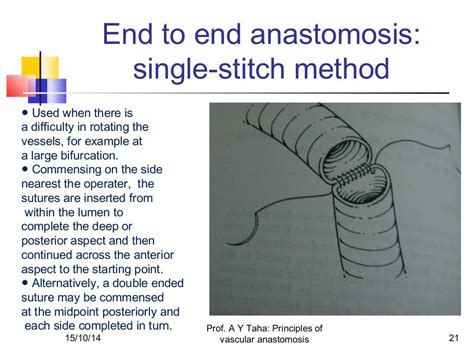 Principles of vascular anastomosis