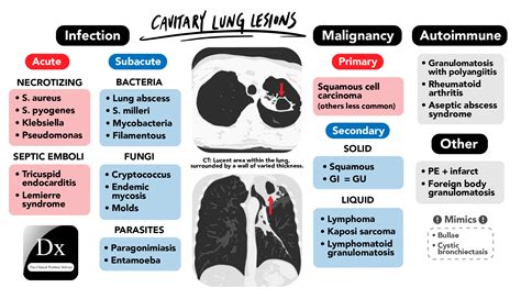 Dx schema – Lung Cavity – The Clinical Problem Solvers