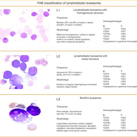 Acute Lymphoblastic Leukemia Detection And Classification Of Its | Hot ...