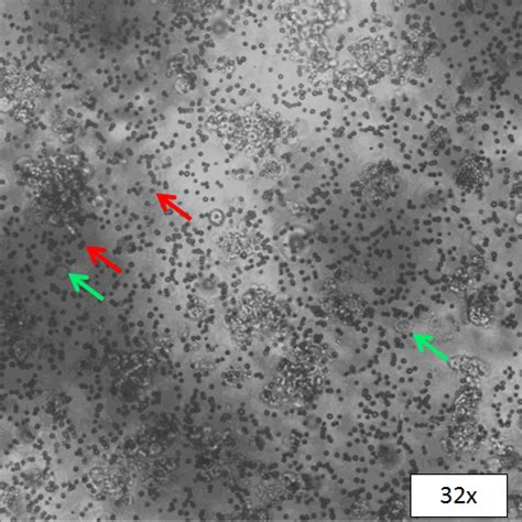 8 questions with answers in CHROMAFFIN CELLS | Science topic