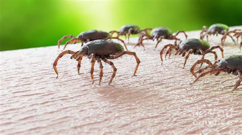 Ticks On Human Skin Photograph by Sebastian Kaulitzki/science Photo Library | Fine Art America