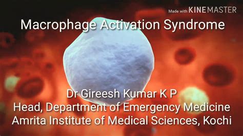 Macrophage activation syndrome by Dr Gireesh Kumar K P - YouTube