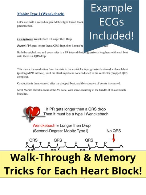 AV Heart Block Types PDF: Poem, ECG Explained, EKG Rhythm Strips Made ...