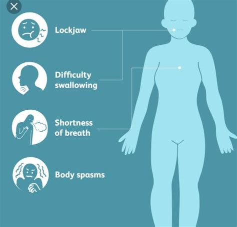 Tetanus - Symptoms, Causes, Complications & Treatment - Santripty