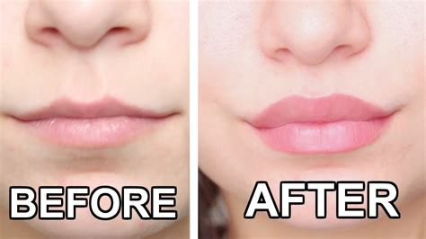 How To Make Lips Bigger Permanently Without Surgery | Lipstutorial.org