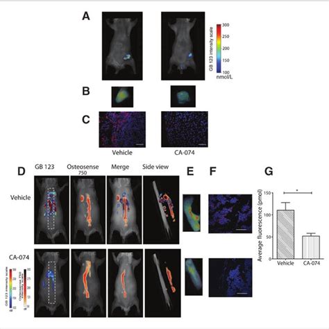 Cathepsin B levels in human breast tumors (A) and mouse 4T1.2 tumors... | Download Scientific ...