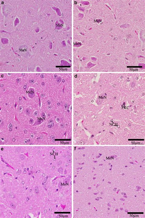 Effect of parsley treatment on the histology of medulla oblongata.... | Download Scientific Diagram