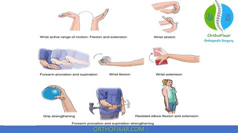 Medial Epicondylitis Exercises