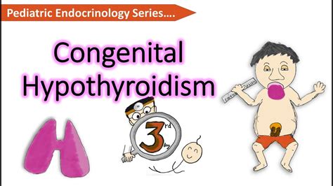 Congenital Hypothyroidism