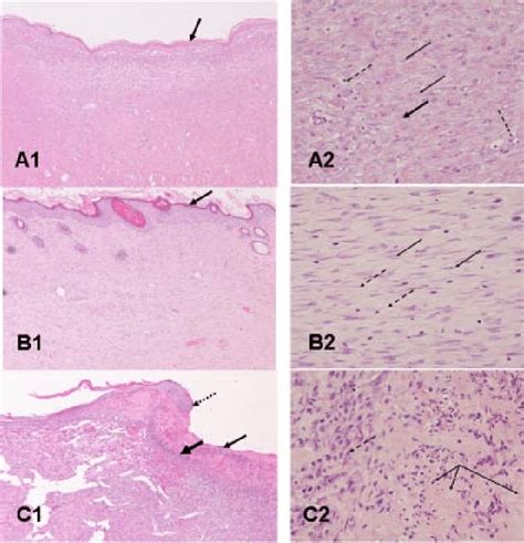 Wound histology at day 19. A1: Sham-irradiated control wound showing... | Download Scientific ...