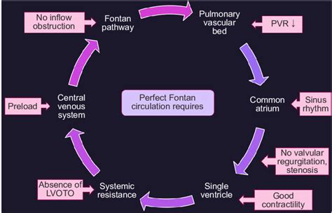 Requirements for a perfect Fontan circulation. Factors at each ...