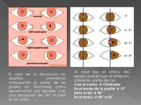 Test empleados en optometria : TEST DE HISCHBERG