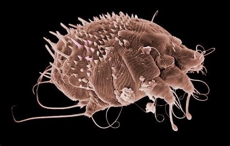 Scabies Mite Photograph by Natural History Museum, London/science Photo Library - Pixels