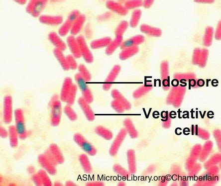 Endospore Staining Flashcards | Quizlet