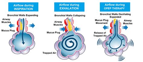 Smoke Doesn't Cause Asthma Attacks, It Causes Respiratory Attacks