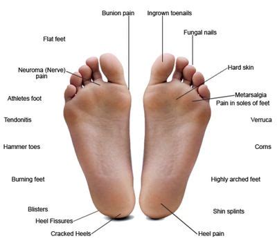 Common Foot Conditions