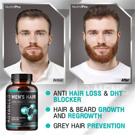 Hair Growth Supplements For Men - Anti Hair Loss Pills.For Hair & Beard.120caps 92617993820 | eBay