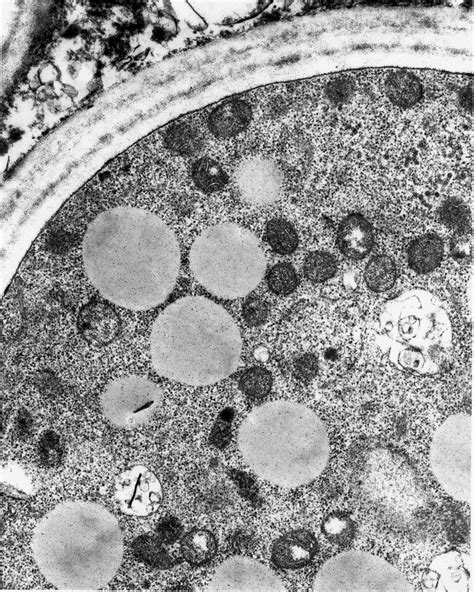 Cell Wall Electron Microscope