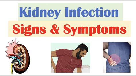 Kidney Infection (Pyelonephritis) Signs Symptoms Why They, 48% OFF