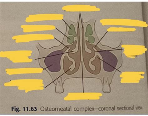 Osteomeatal complex - coronal sectional view Quiz