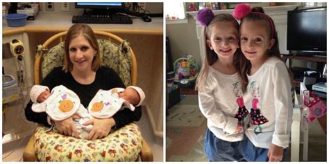 A Beautiful Gallery of Preemie Twins: Before and After! - Twiniversity