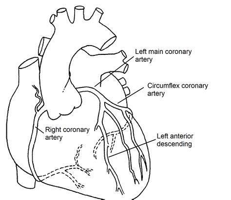 Printable Coronary Artery Diagram