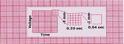 ecg-graph-paper - Cardiac Sciences Manitoba