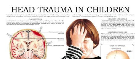 Head trauma in children – Anejo