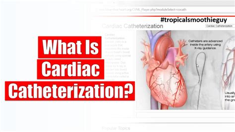 cardiac catheterization