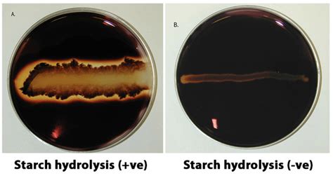 Starch Hydrolysis Test Lectures, Microbiology - on Study Boss