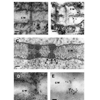 Ultrastructure of plasmodesmata in active (A,B) and deactivated (C-E)... | Download Scientific ...