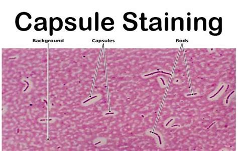 Capsule Staining- Principle, Reagents, Procedure and Result