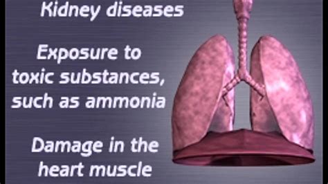 Fluid In Lungs X Ray