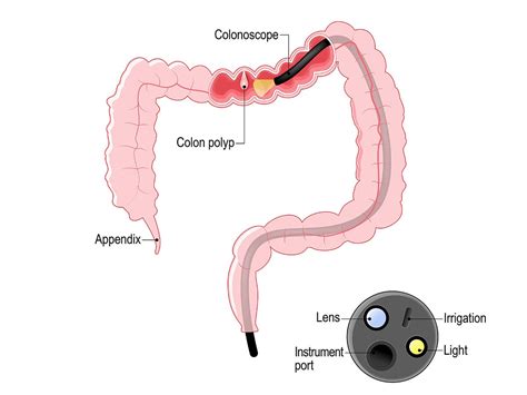 A/Prof Jaber | Gastroscopy and Colonoscopy