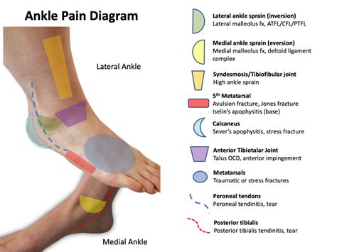 Sports Medicine: Just-in-Time Training – CEEI