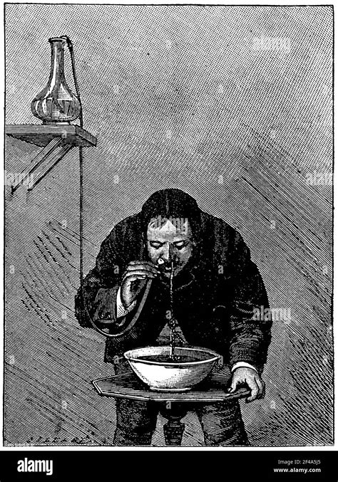 Using the nasal douche. Illustration of the 19th century. Germany ...