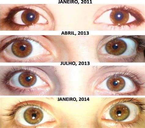 Want To Change Your Eye Colour? - Musely