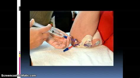 Picc Line Care - YouTube