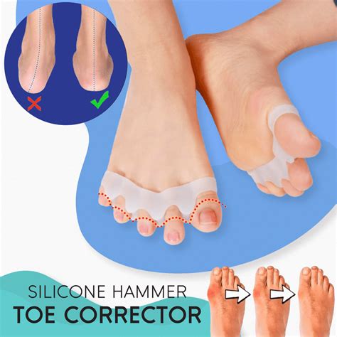 Silicone Hammer Toe Corrector | Hammer toe, Hammer toe correction, Toe alignment