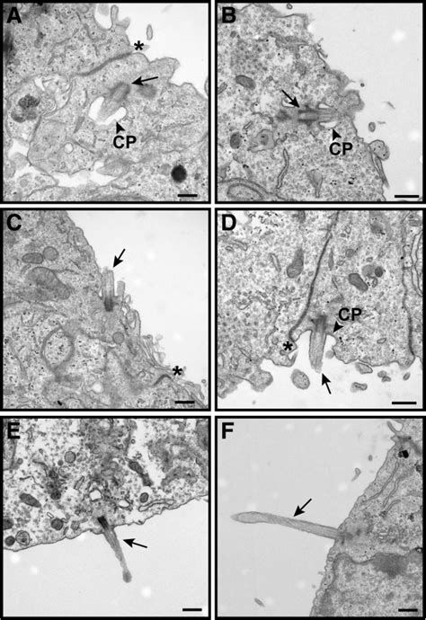 Genesis of ependymal cell primary cilia appears normal in P0... | Download Scientific Diagram