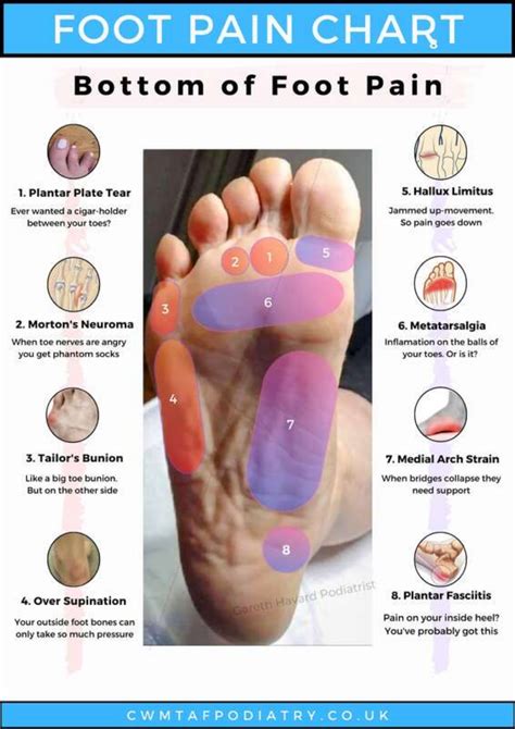 Foot Pain Chart - Bottom of Foot Pain Download Printable PDF | Templateroller