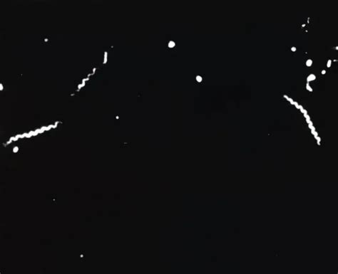 Demonstration of Treponema pallidum Using Dark-Field Microscopy ...