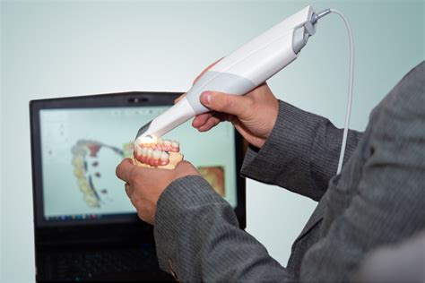 What Is An Intraoral Digital Scanner And How Does It Benefit Patients?